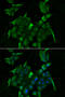 Solute Carrier Family 34 Member 1 antibody, STJ28825, St John