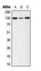 EPH Receptor B1 antibody, orb224166, Biorbyt, Western Blot image 