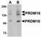 PR domain zinc finger protein 16 antibody, NBP1-71992, Novus Biologicals, Western Blot image 