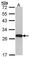 Myosin Light Chain 3 antibody, PA5-27819, Invitrogen Antibodies, Western Blot image 
