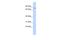 TTP antibody, A14110, Boster Biological Technology, Western Blot image 