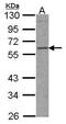 Transcription Factor EB antibody, PA5-21616, Invitrogen Antibodies, Western Blot image 