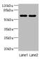 Zinc Finger Protein 215 antibody, A63816-100, Epigentek, Western Blot image 