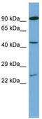 Paired Box 8 antibody, TA346519, Origene, Western Blot image 