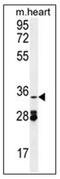 Oxidoreductase NAD Binding Domain Containing 1 antibody, AP53140PU-N, Origene, Western Blot image 