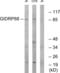 R3H Domain And Coiled-Coil Containing 1 Like antibody, abx014502, Abbexa, Western Blot image 