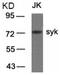 Spleen Associated Tyrosine Kinase antibody, LS-C203093, Lifespan Biosciences, Western Blot image 