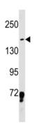 LIM Domain 7 antibody, abx034666, Abbexa, Western Blot image 