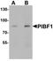 Progesterone Immunomodulatory Binding Factor 1 antibody, TA319821, Origene, Western Blot image 