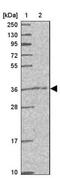 Calcium Modulating Ligand antibody, NBP2-33661, Novus Biologicals, Western Blot image 