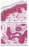 TEP1 antibody, MBS194438, MyBioSource, Immunohistochemistry paraffin image 