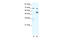 DEAD-Box Helicase 55 antibody, 28-499, ProSci, Western Blot image 