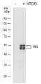 Thymine DNA Glycosylase antibody, GTX631589, GeneTex, Western Blot image 