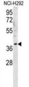 Olfactory Receptor Family 2 Subfamily AK Member 2 antibody, abx026659, Abbexa, Western Blot image 