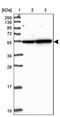 LUC7 Like 2, Pre-MRNA Splicing Factor antibody, PA5-62446, Invitrogen Antibodies, Western Blot image 
