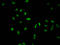 Histone Cluster 1 H1 Family Member C antibody, LS-C670334, Lifespan Biosciences, Immunofluorescence image 