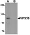 VPS39 Subunit Of HOPS Complex antibody, A05711, Boster Biological Technology, Western Blot image 