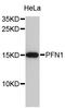 Profilin 1 antibody, abx127006, Abbexa, Western Blot image 