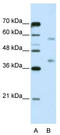 Heterogeneous Nuclear Ribonucleoprotein A3 antibody, TA344035, Origene, Western Blot image 