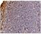 Death Domain Associated Protein antibody, PA1809, Boster Biological Technology, Immunohistochemistry paraffin image 