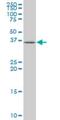 Eukaryotic Translation Initiation Factor 3 Subunit H antibody, H00008667-M01, Novus Biologicals, Western Blot image 