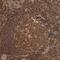 Prefoldin Subunit 4 antibody, HPA024055, Atlas Antibodies, Immunohistochemistry paraffin image 