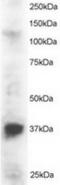 PIN2 (TERF1) Interacting Telomerase Inhibitor 1 antibody, TA302765, Origene, Western Blot image 
