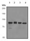 Signal Transducer And Activator Of Transcription 1 antibody, ab92506, Abcam, Western Blot image 