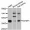 Insulin Like Growth Factor Binding Protein 1 antibody, A2981, ABclonal Technology, Western Blot image 