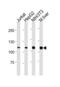 Nuclear Receptor Subfamily 3 Group C Member 1 antibody, abx034782, Abbexa, Western Blot image 