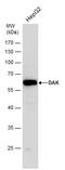 Triokinase And FMN Cyclase antibody, GTX111471, GeneTex, Western Blot image 