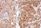 Steroidogenic Acute Regulatory Protein antibody, PA5-21687, Invitrogen Antibodies, Immunohistochemistry frozen image 