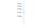 Nudix Hydrolase 9 antibody, A07995, Boster Biological Technology, Western Blot image 