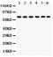 Protein Kinase C Delta antibody, RP1058, Boster Biological Technology, Western Blot image 