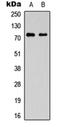 Solute Carrier Family 44 Member 1 antibody, orb304588, Biorbyt, Western Blot image 