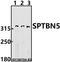 Spectrin Beta, Non-Erythrocytic 5 antibody, A12999-1, Boster Biological Technology, Western Blot image 