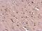 Von Hippel-Lindau Tumor Suppressor antibody, PA5-27322, Invitrogen Antibodies, Immunohistochemistry frozen image 