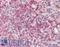 NOX5 antibody, LS-B15518, Lifespan Biosciences, Immunohistochemistry paraffin image 