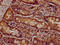 Par-3 Family Cell Polarity Regulator antibody, LS-C371660, Lifespan Biosciences, Immunohistochemistry paraffin image 