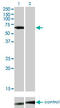 LCK Proto-Oncogene, Src Family Tyrosine Kinase antibody, LS-C197606, Lifespan Biosciences, Western Blot image 