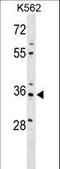 PDZ And LIM Domain 4 antibody, LS-C158566, Lifespan Biosciences, Western Blot image 