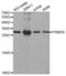 Proteasome 26S Subunit, Non-ATPase 9 antibody, abx004098, Abbexa, Western Blot image 