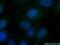 ADP Ribosylation Factor Like GTPase 13B antibody, 66739-1-Ig, Proteintech Group, Immunofluorescence image 