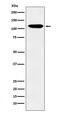 ETK2 antibody, M04659-1, Boster Biological Technology, Western Blot image 