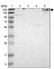Spectrin Beta, Non-Erythrocytic 1 antibody, PA5-52970, Invitrogen Antibodies, Western Blot image 