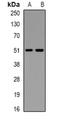 Coagulation Factor IX antibody, orb382690, Biorbyt, Western Blot image 