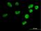 IGF Like Family Receptor 1 antibody, H00199746-B01P, Novus Biologicals, Immunocytochemistry image 