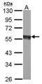 Eukaryotic Translation Initiation Factor 5 antibody, PA5-30223, Invitrogen Antibodies, Western Blot image 