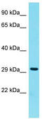 H1 Histone Family Member N, Testis Specific antibody, TA344392, Origene, Western Blot image 