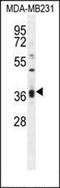 Kelch Like Family Member 35 antibody, orb30113, Biorbyt, Western Blot image 